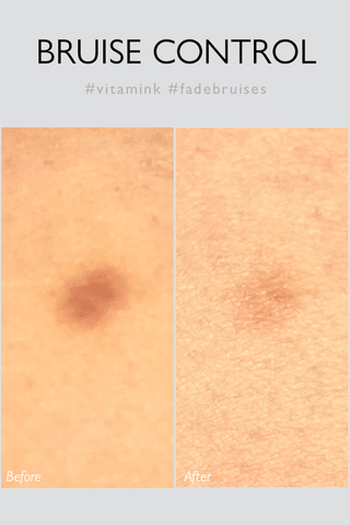 Bluecalm Rescue Gel 10ml - K - Dermatology Skincare by Genabelle