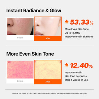 Genabelle PDRN Vita Toning Ampoule - K-Dermatology Skincare by Genabelle