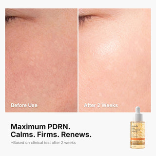 Genabelle PDRN Vita Toning Ampoule - K-Dermatology Skincare by Genabelle