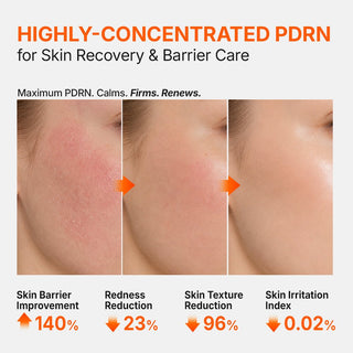 PDRN 3% Hyper Boost Ampoule - K - Dermatology Skincare by Genabelle