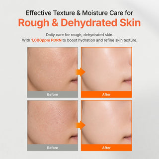 PDRN Rejuvenating Toner 300ml - K-Dermatology Skincare by Genabelle